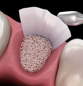 Jaw Surgeon Charlotte