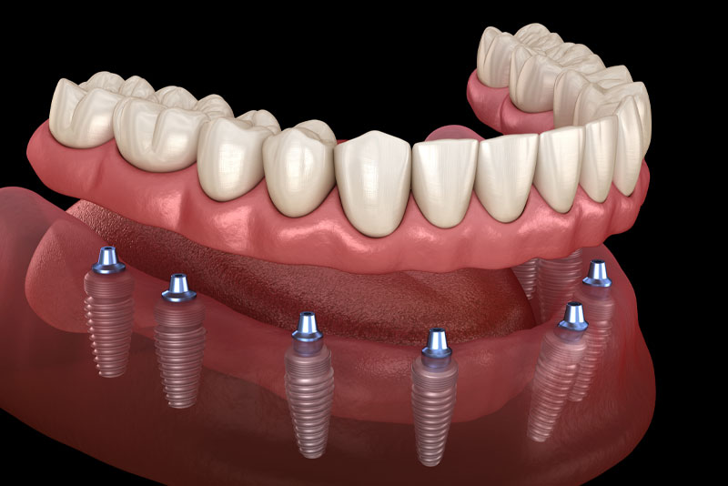 Dental Surgery Charlotte