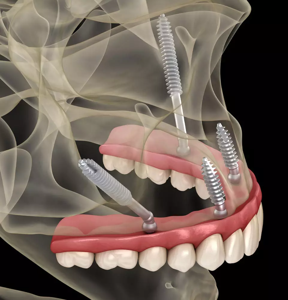 Maxillofacial Surgeon Charlotte NC