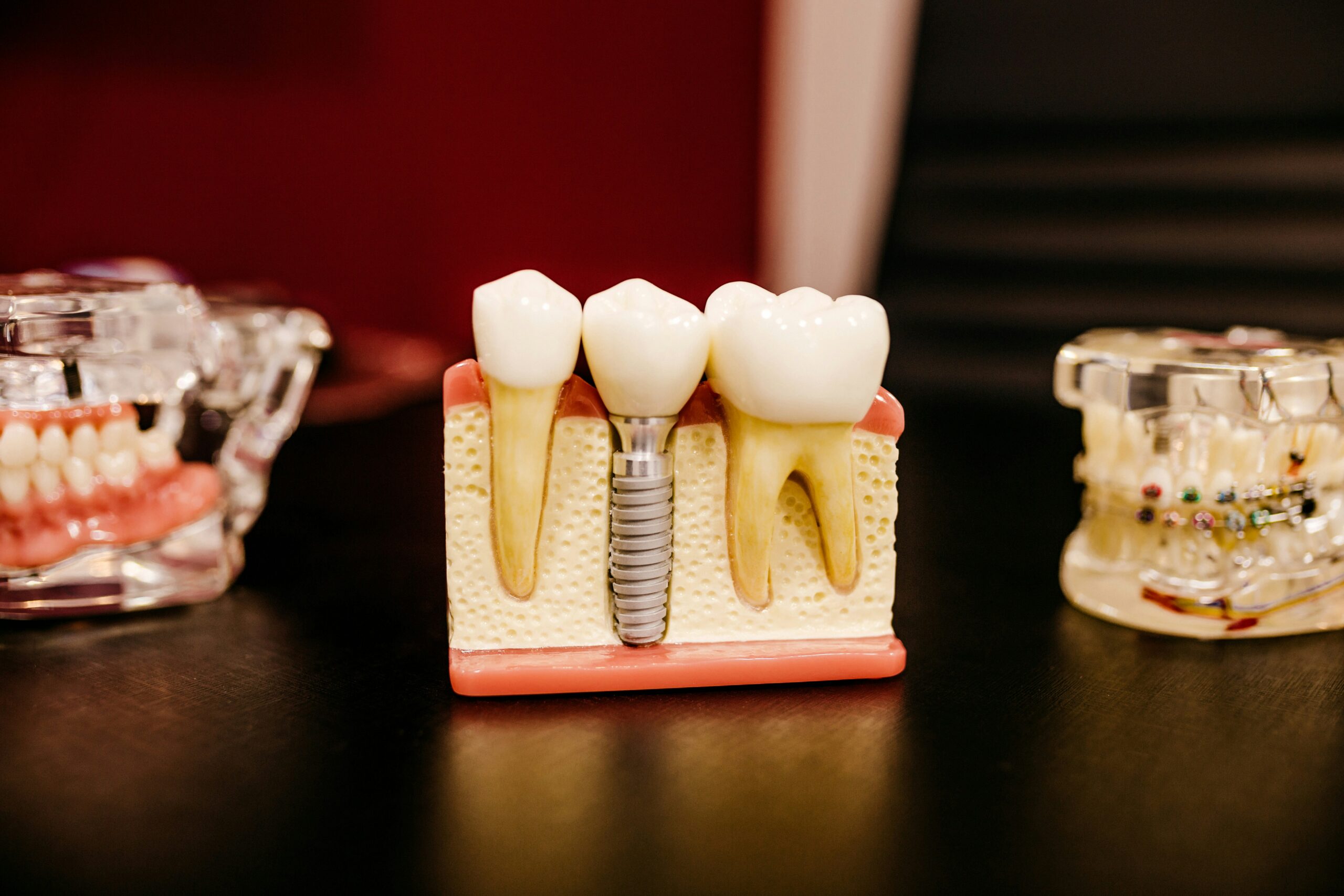 tooth implant indian land