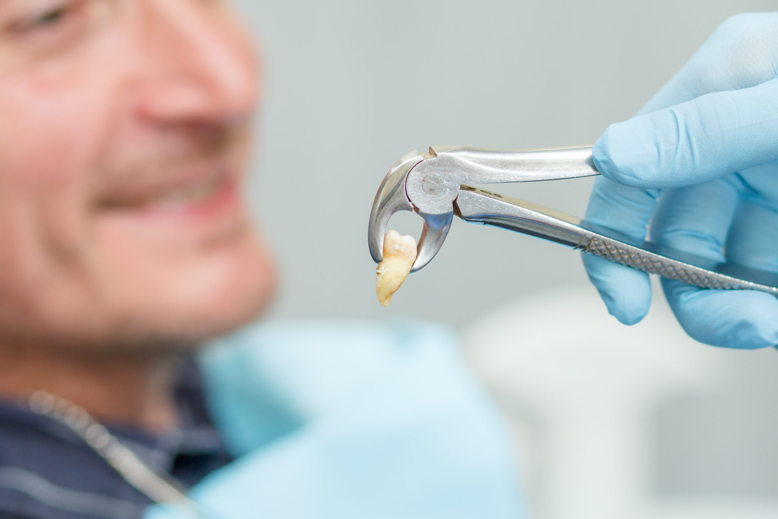 Tooth Extraction Aftercare