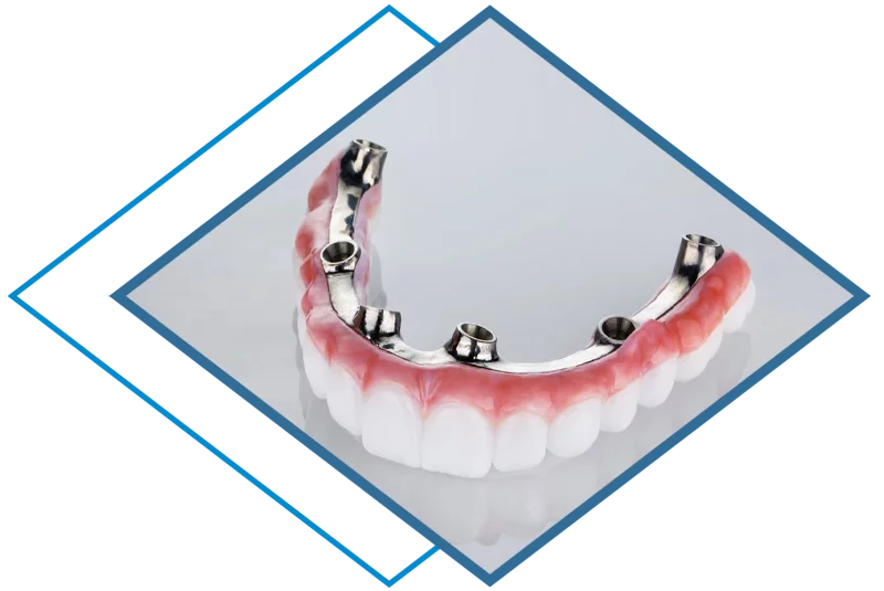 zirconia dental bridge
