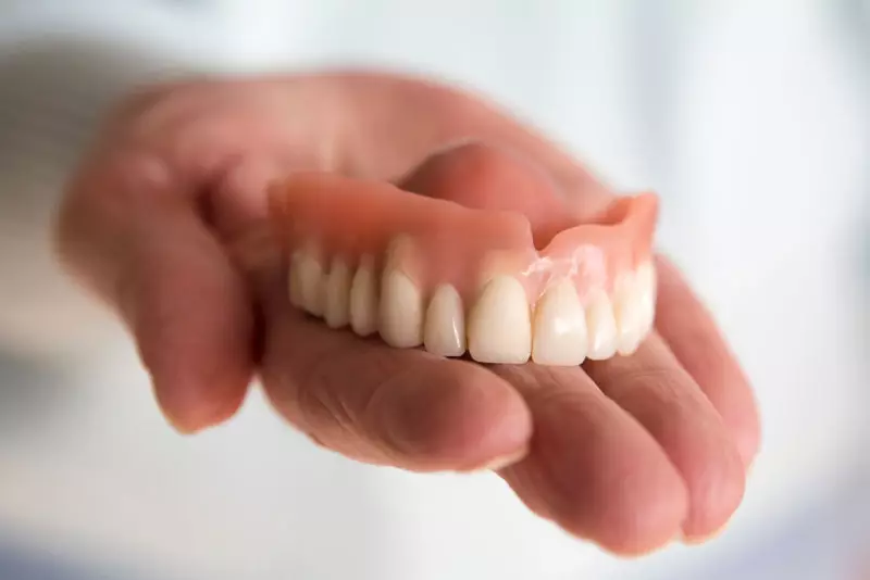 fixed dental implants